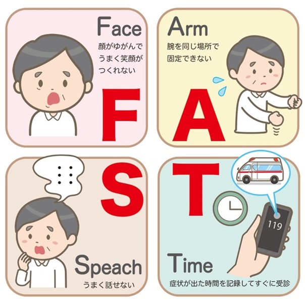 「FAST」と呼ばれる方法